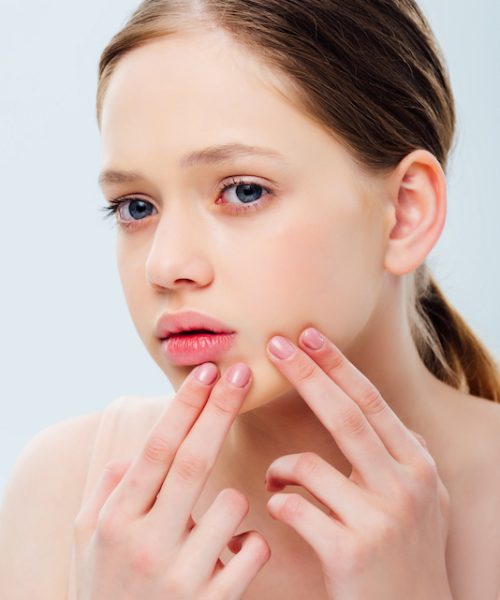 upset teenage girl with acne touching face isolated on grey